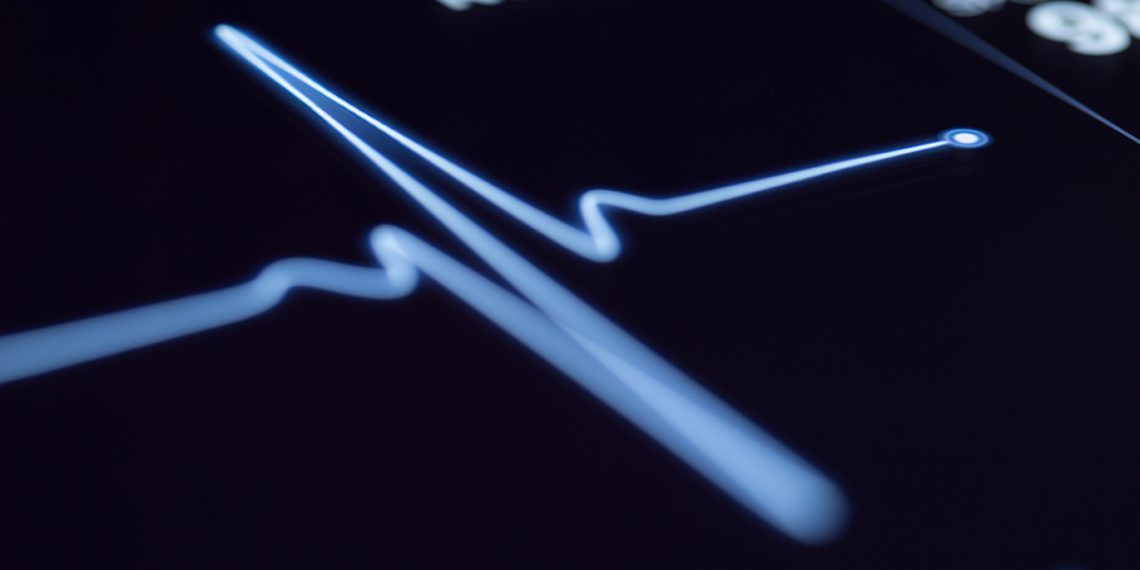 Abbott veröffentlicht Daten, die zeigen, dass Künstliche Intelligenz Ärzten helfen kann, besser zu bestimmen, ob Patienten einen Herzinfarkt erlitten haben