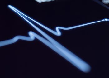 Abbott veröffentlicht Daten, die zeigen, dass Künstliche Intelligenz Ärzten helfen kann, besser zu bestimmen, ob Patienten einen Herzinfarkt erlitten haben