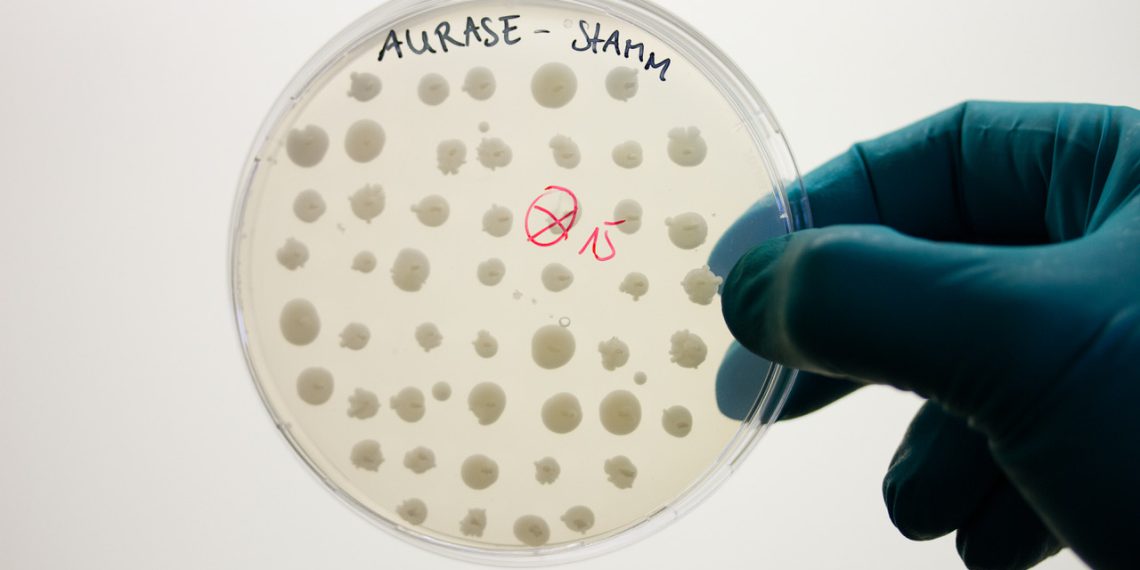 SolasCure Ltd. wird Medizinprodukte vermarkten, die auf dem neuen von der Brain AG entwickelten enzymatischen Wirkstoff Aurase beruhen.