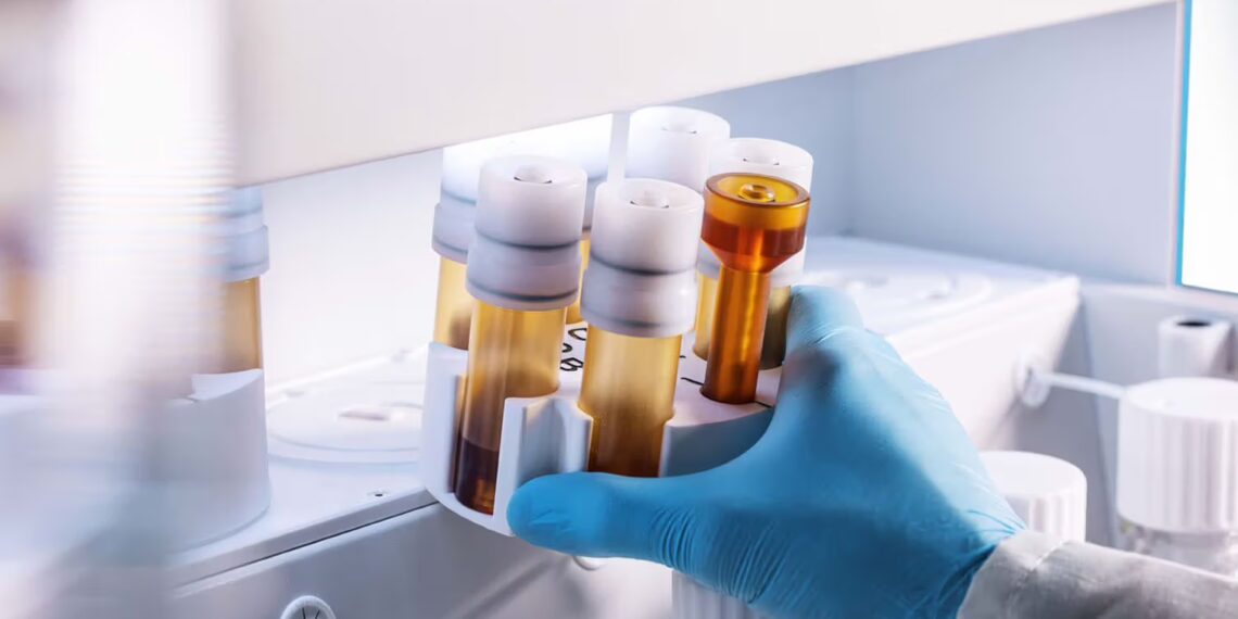 Automatisierte Probenvorbereitung