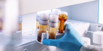 Automatisierte Probenvorbereitung