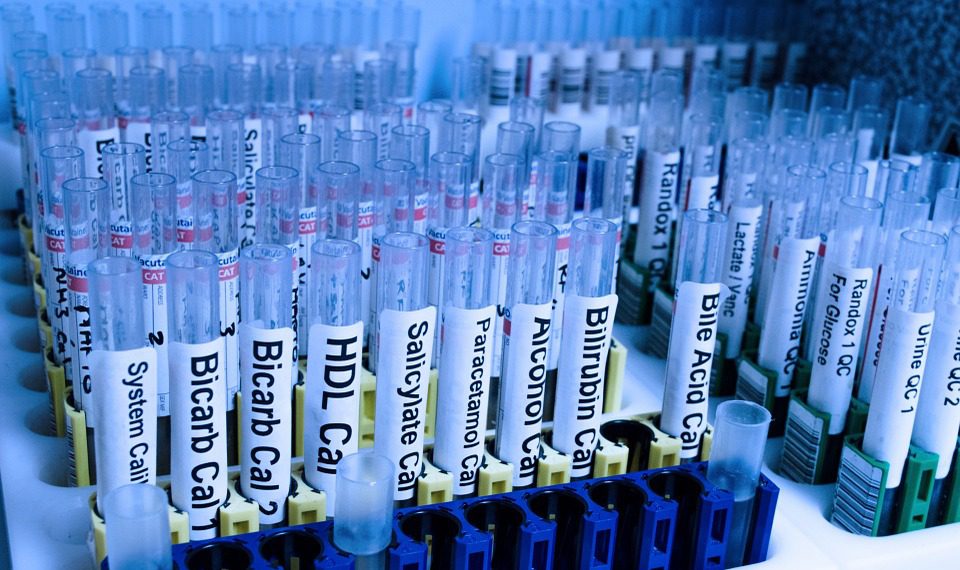 Test Rohr Labor Medizinische Forschung Medikament